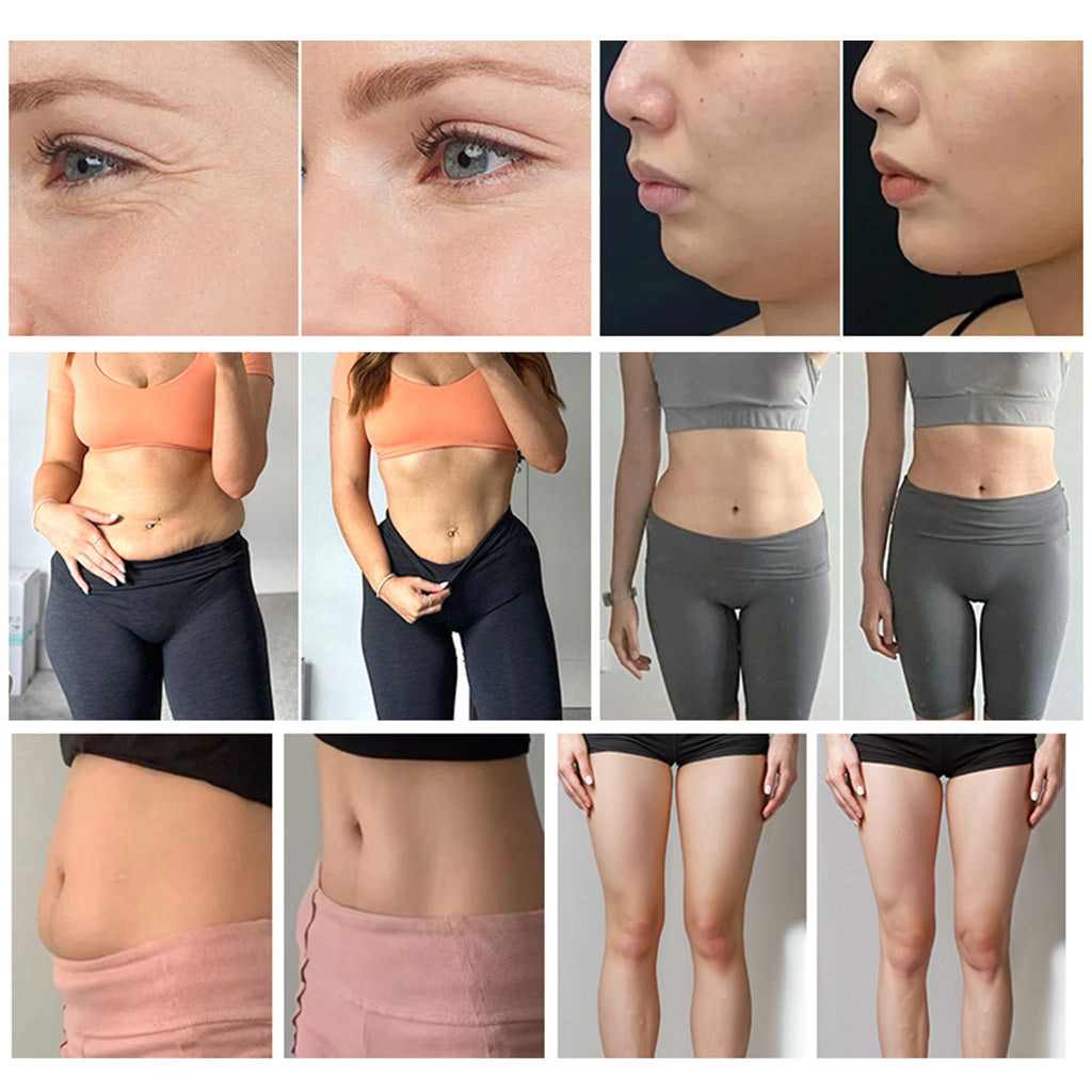 Red Light Infrared Lipo Laser Pad System for Body Shaping & Cellulite Reduction
