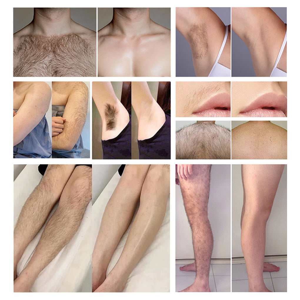 Professional IPL Hair Removal Machine OPT SHR Technology for Salon & Spa Use