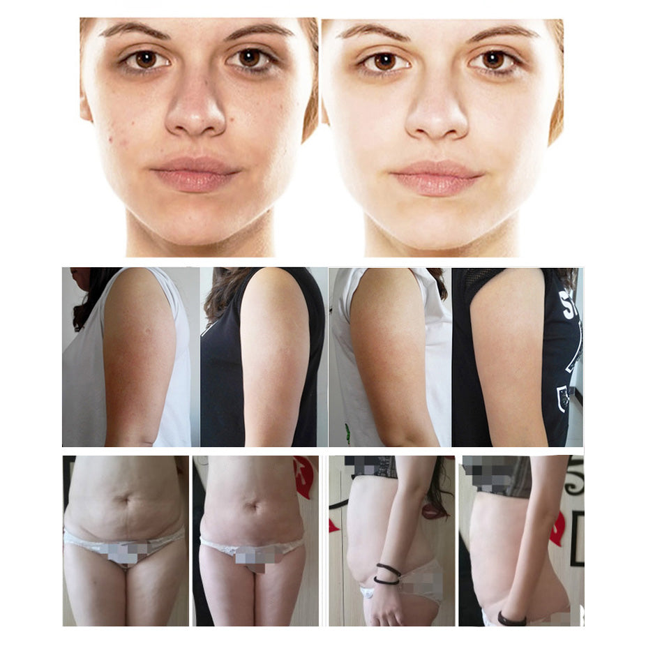 Vacuum Roller Body Contouring Device 40K Cavitation Cellulite Reduction Weight Loss Machine