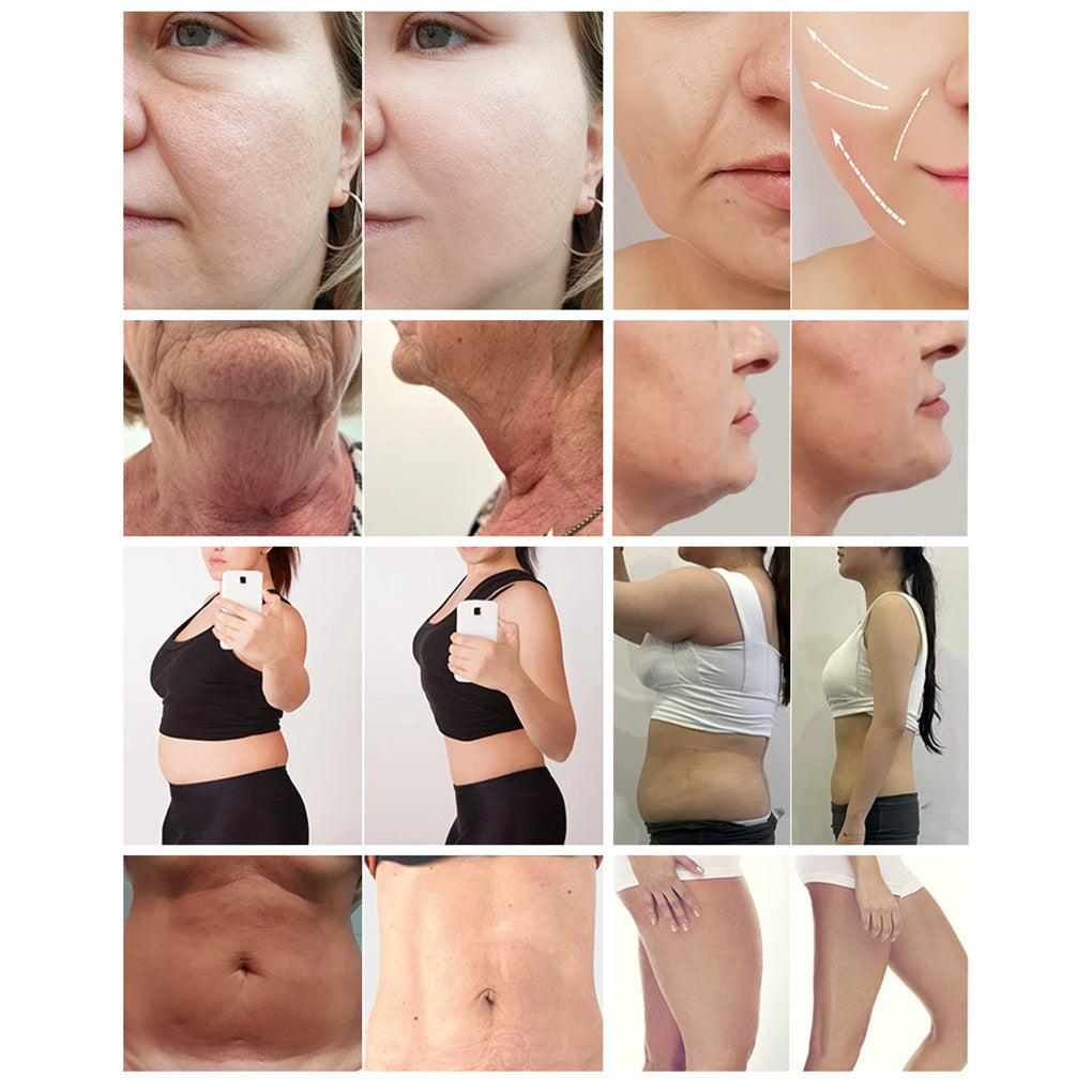 2.45GHz Coolwave Cellulite Treatment Machine Deep Fat Reduction Technology for Beauty Salon