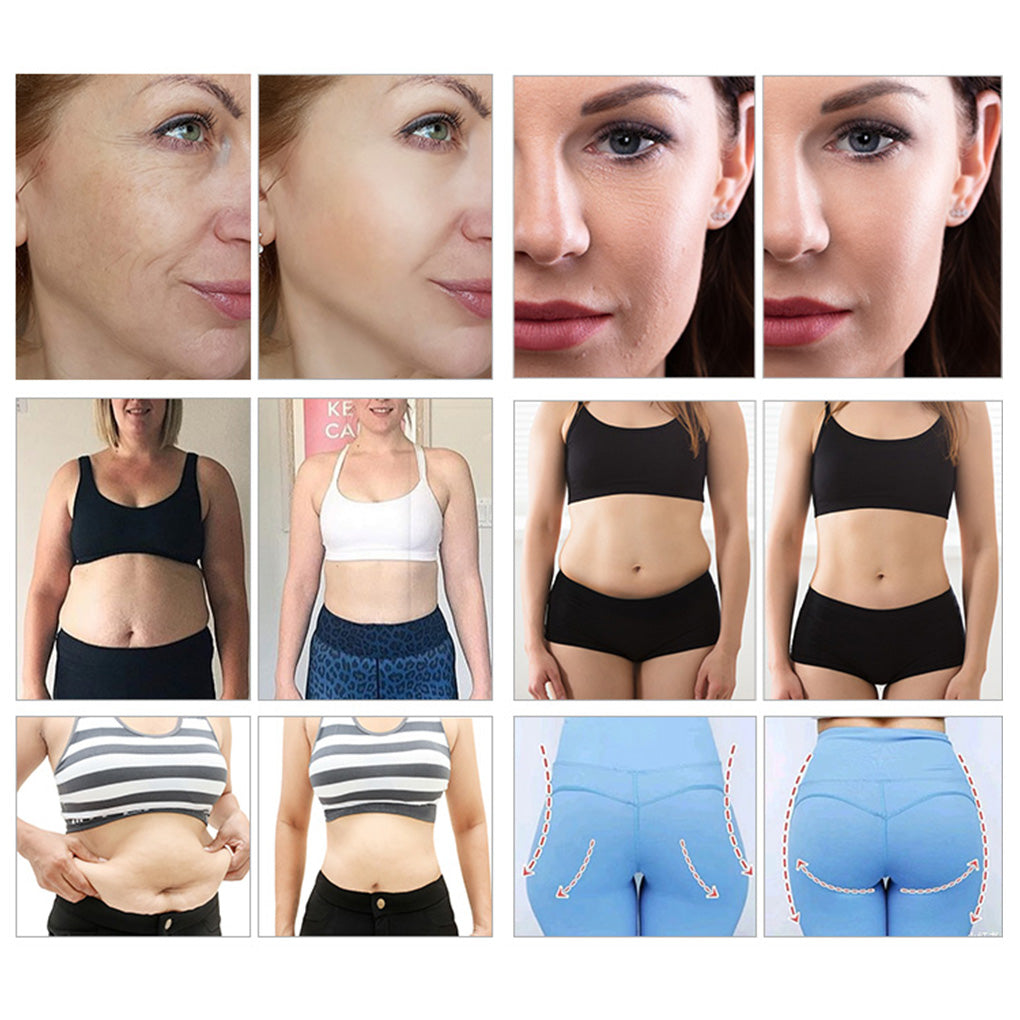 Wellness Clinic Portable Shockwave Therapy Machine for ED Fat Loss & Pain Release