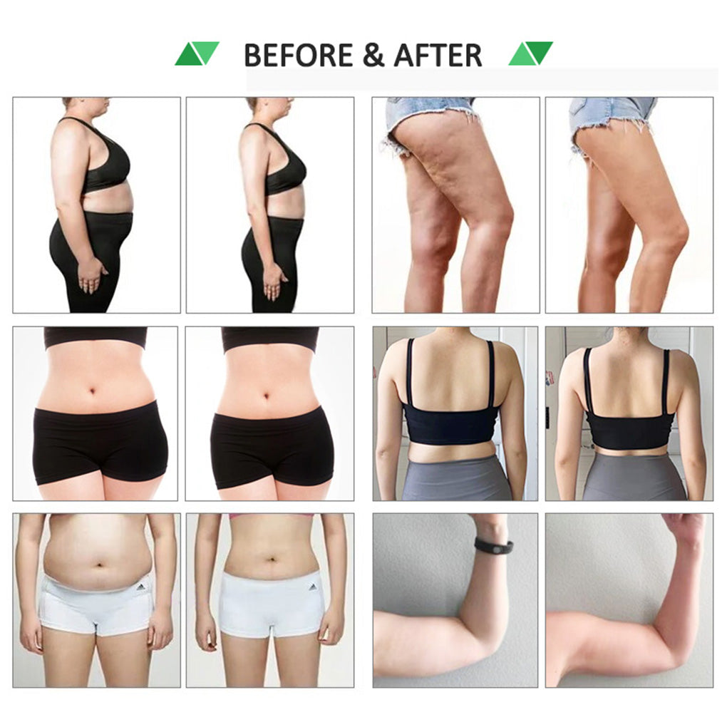 Body Contouring Machine with Cryolipolysis Cooling Plate and EMS Muscle Stimulation