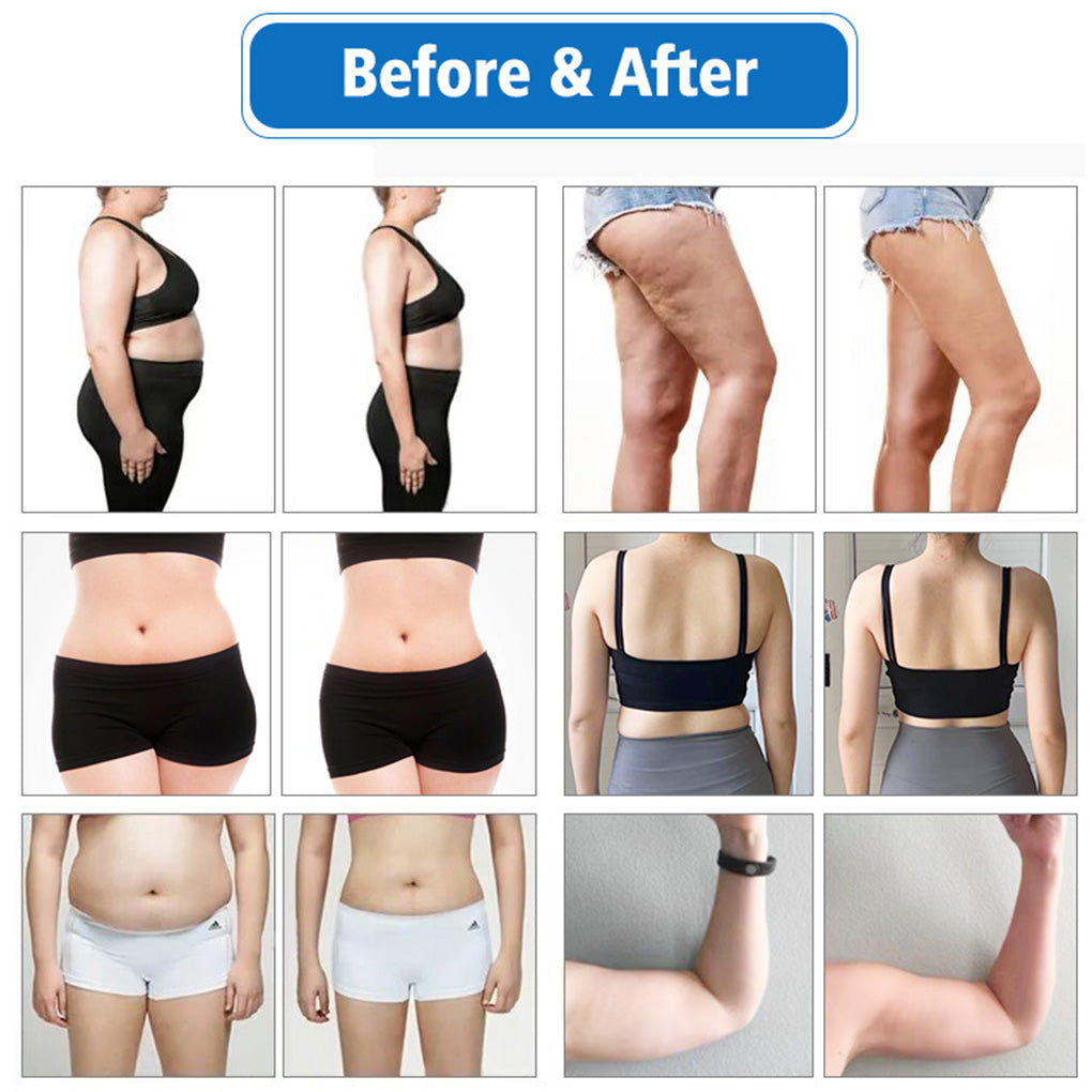 Cryo Fat Freezing Plate Machine with EMS + Laser Lipolysis for Distributor Supply