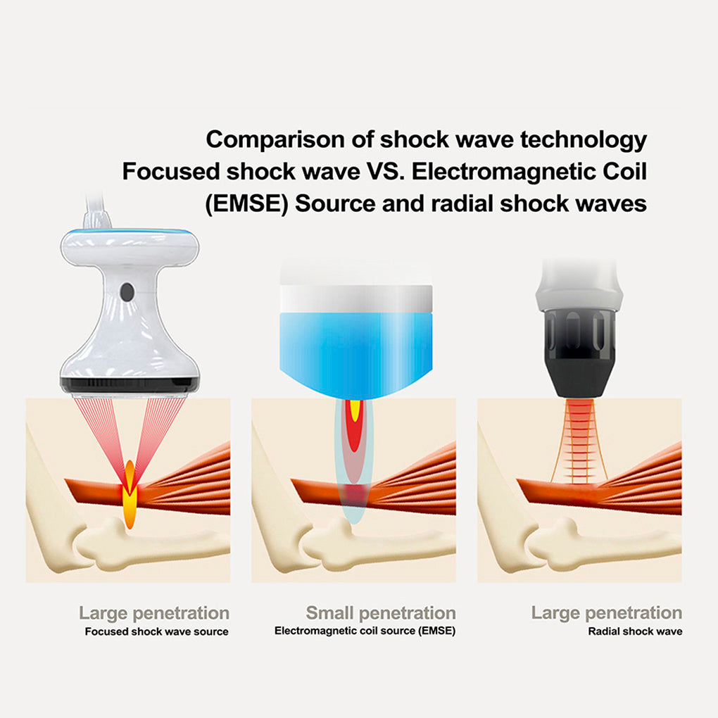 High Intensity Focused Shockwave Therapy Machine for Back Pain Knee Pain Sports Medicine Equipment