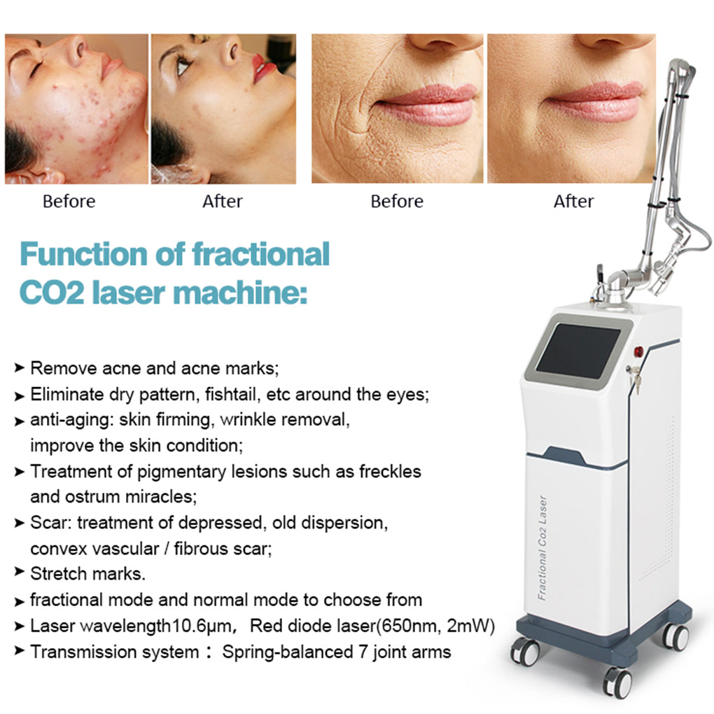 Fractional CO₂ Laser System for Multi Function Aesthetic Treatments Skin Rejuvenation and Pigmentation Correction