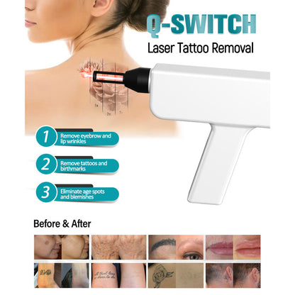 Professional Beauty Equipment 2-in-1 IPL & Q-Switch Laser Machine for Hair Removal and Tattoo Removal