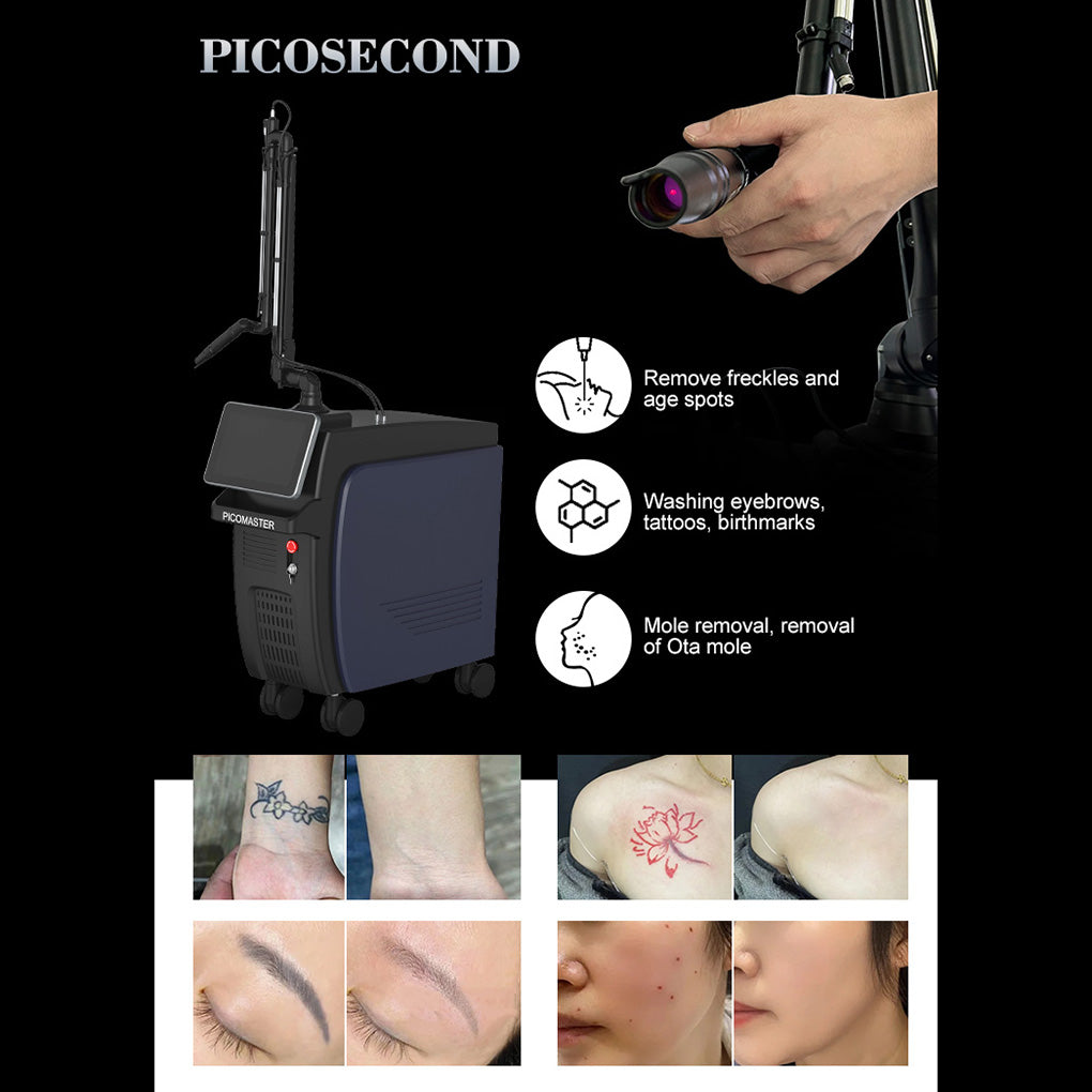 Carbon Peeling Laser Machine Q Switch ND YAG Tattoo Removal Pigmentation Removal Beauty Equipment