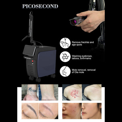 Carbon Peeling Laser Machine Q Switch ND YAG Tattoo Removal Pigmentation Removal Beauty Equipment