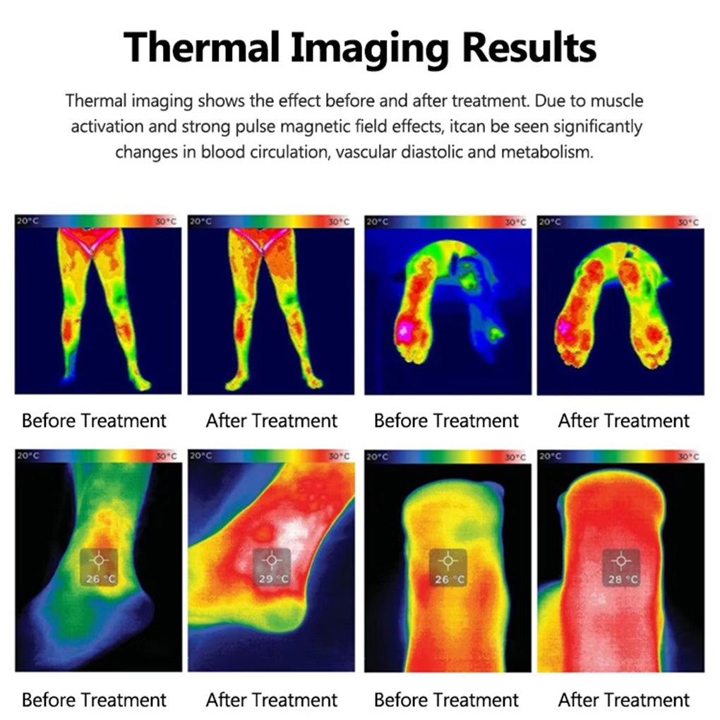 TMS Magnetic Pulse Therapy Ring Device Non-Invasive Muscle & Joint Recovery Equipment
