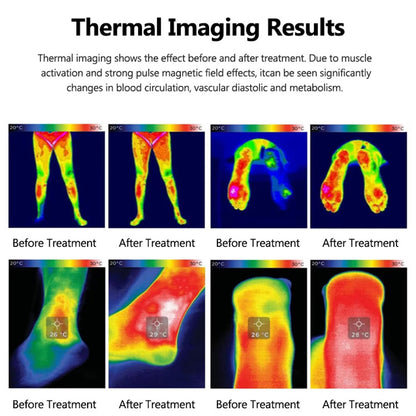 TMS Magnetic Pulse Therapy Ring Device Non-Invasive Muscle & Joint Recovery Equipment