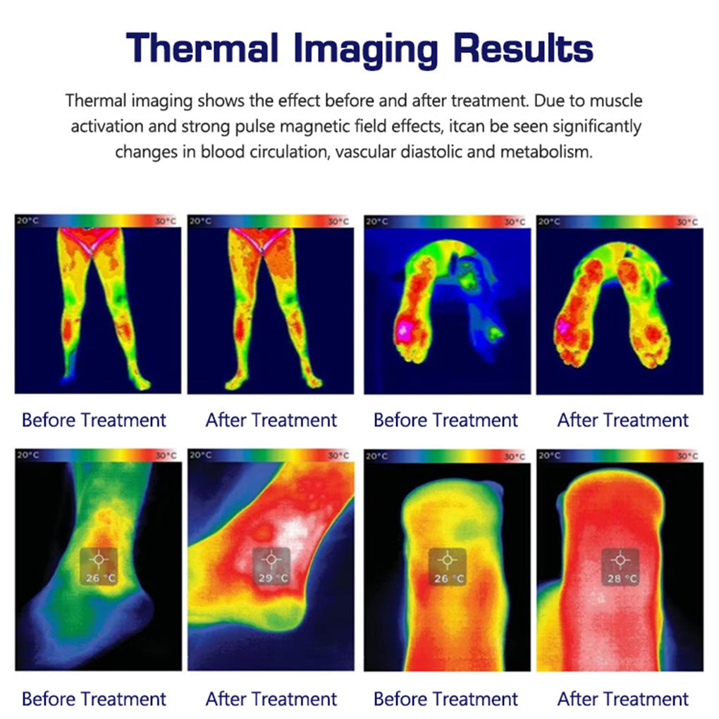 Magnetic Pulse Therapy Device Muscle Recovery & Joint Pain Relief