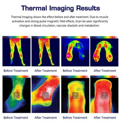 Magnetic Pulse Therapy Device Muscle Recovery & Joint Pain Relief
