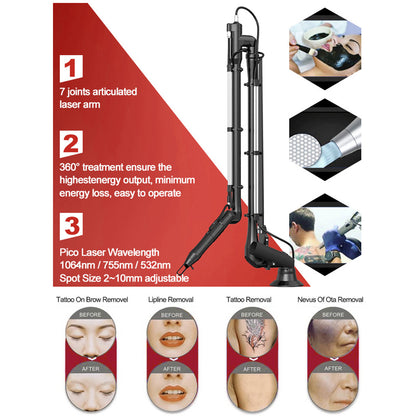 ND YAG Q Switch Laser Tattoo Removal Machine Carbon Laser Peel Skin Whitening Beauty Device