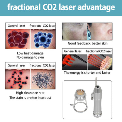 Fractional CO₂ Laser System for Multi Function Aesthetic Treatments Skin Rejuvenation and Pigmentation Correction