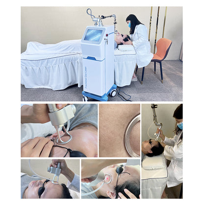 Fractional CO₂ Laser System for Multi Function Aesthetic Treatments Skin Rejuvenation and Pigmentation Correction