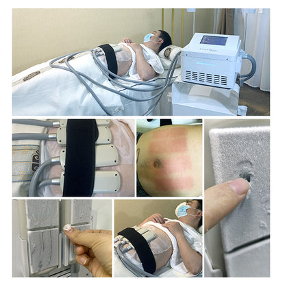 Non-Vacuum Cryolipolysis Cooling Pads Fat Freezing Machine for Body Contouring