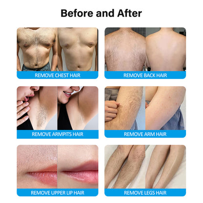 Advanced Diode Laser Hair Removal System for Beauty Clinics and Med Spas Ice Hair Removal Machine