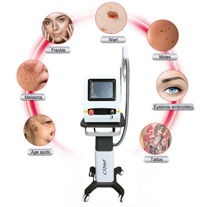 Advanced Tattoo Removal Machine Carbon Peeling Laser for Freckles, Birthmarks & Eyebrow Tattoo Fix