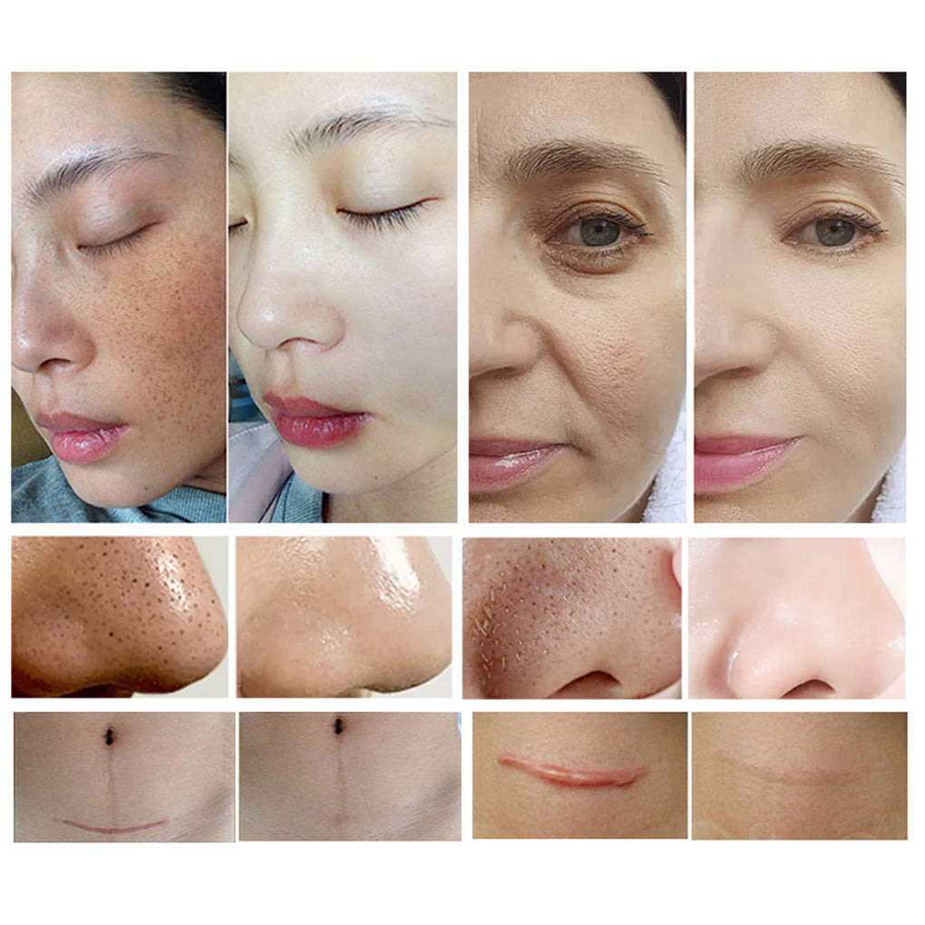 Hydration Deep Cleansing Spa facial Machine Non-Invasive Facial Treatment for Smoother Brighter Skin
