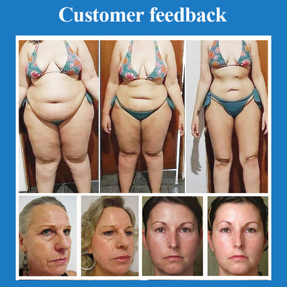 360 Cryolipolysis Machine with Vacuum RF Skin Tightening and Cavitation for Thigh Arm Abdomen Fat Reduction