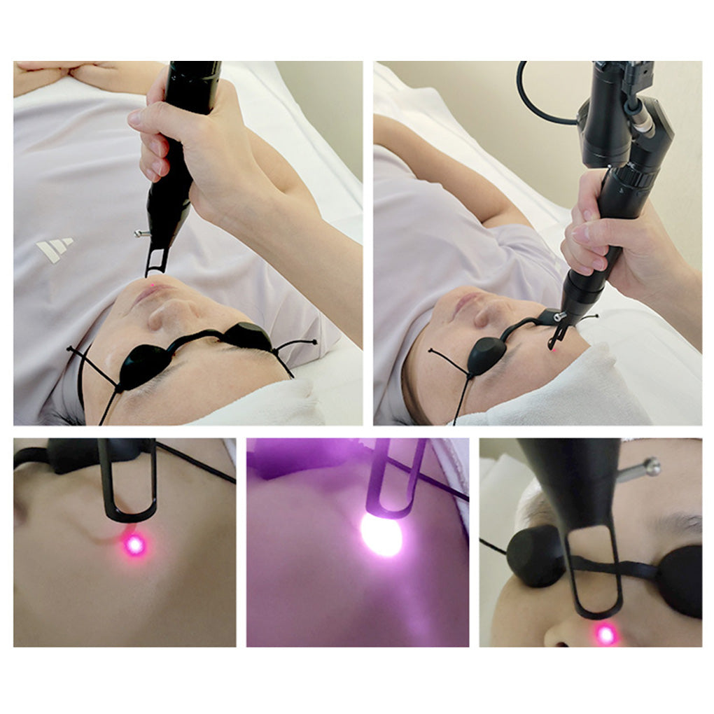 ND YAG Q Switch Laser Tattoo Removal Machine Carbon Laser Peel Skin Whitening Beauty Device
