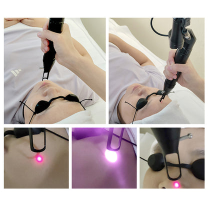 ND YAG Q Switch Laser Tattoo Removal Machine Carbon Laser Peel Skin Whitening Beauty Device
