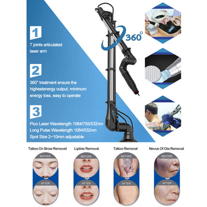 Carbon Peeling Laser Machine Q Switch ND YAG Tattoo Removal Pigmentation Removal Beauty Equipment