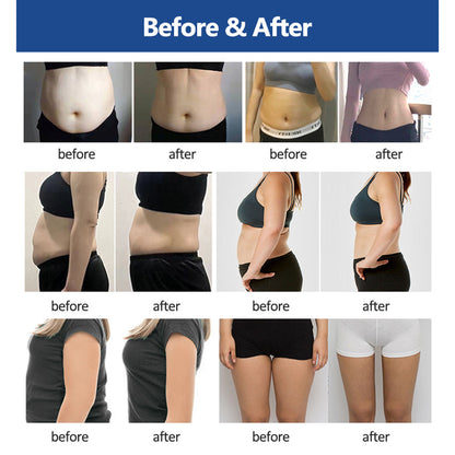 Cryolipolysis Body Sculpting Machine with EMS Technology for Slimming Clinics