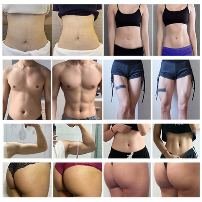 4 Handle EMS Shaping Body Contouring Machine for Muscle Sculpting and Fat Burning