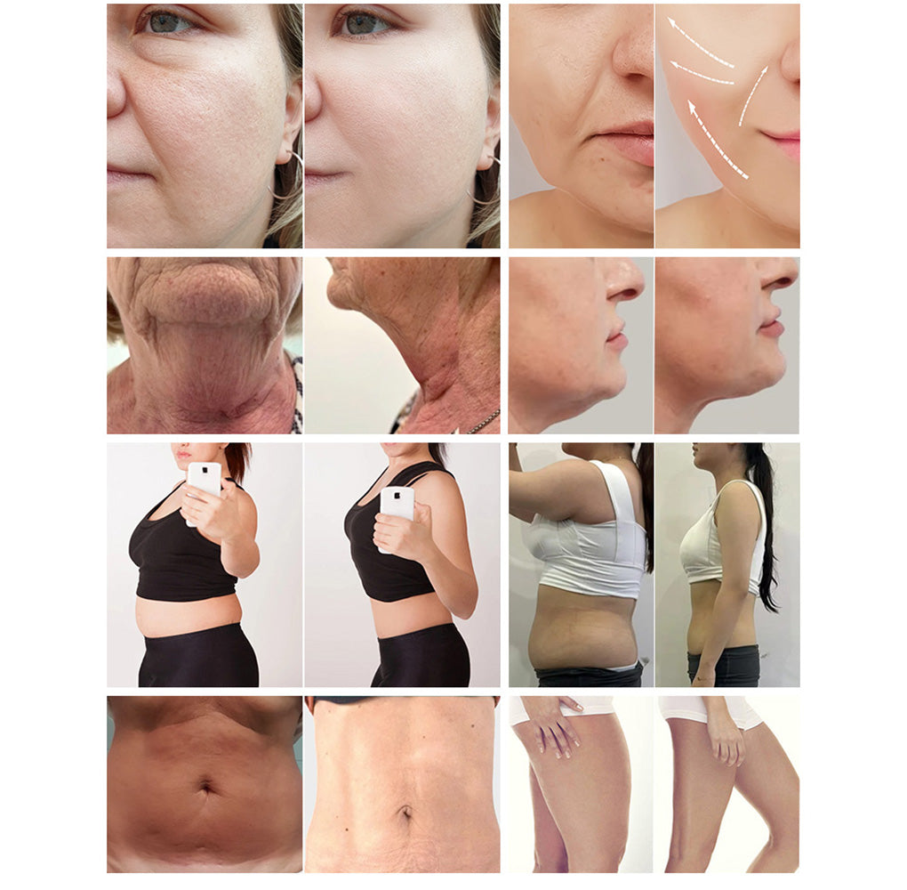 Advanced Microwave Fat Removal Machine Coolwave 2.45GHz Body Contouring System for Clinics