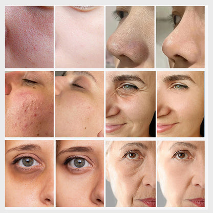 Factory Sale Deep Cleansing Facial Device Pore Extraction & Hydrating Skin Therapy
