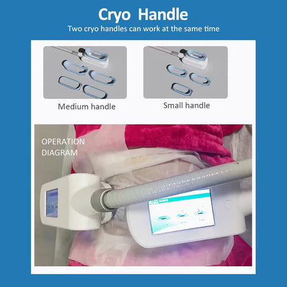 360 Cryolipolysis Machine with Vacuum RF Skin Tightening and Cavitation for Thigh Arm Abdomen Fat Reduction