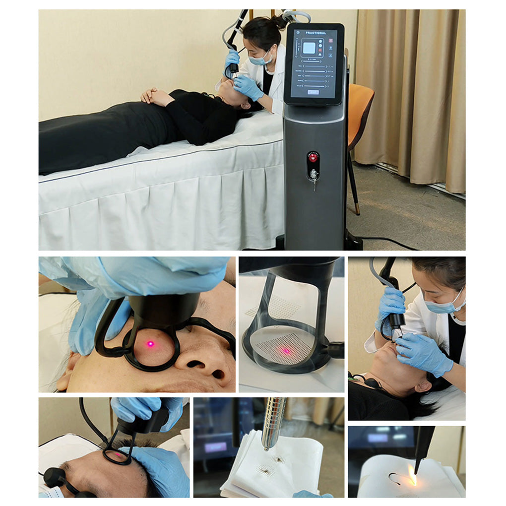 Fractional CO₂ Laser for Professional Skin Resurfacing Wrinkle Removal and Acne Scar Treatment