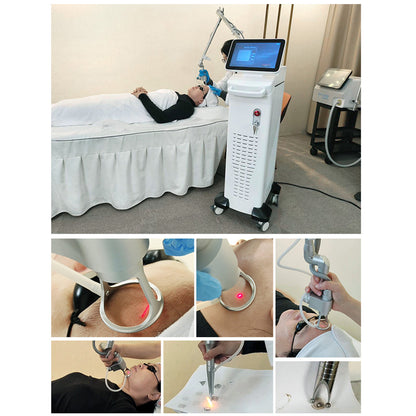 Fractional CO₂ Laser Machine for Fast Recovery Skin Resurfacing Acne Scar and Pigmentation Treatments