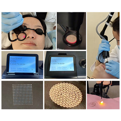 Professional CO₂ Fractional Laser for Scar Wrinkle Pigment Correction and Skin Renewal