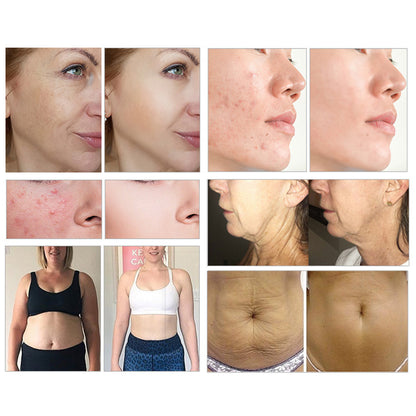 Shockwave Body Therapy Device for Pain Relief Cellulite Reduction & Skin Firming