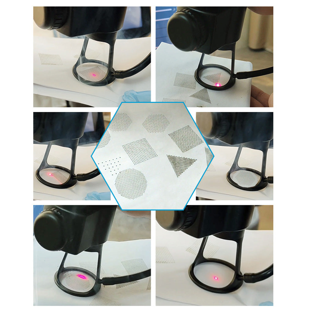 Fractional CO₂ Laser for Professional Skin Resurfacing Wrinkle Removal and Acne Scar Treatment