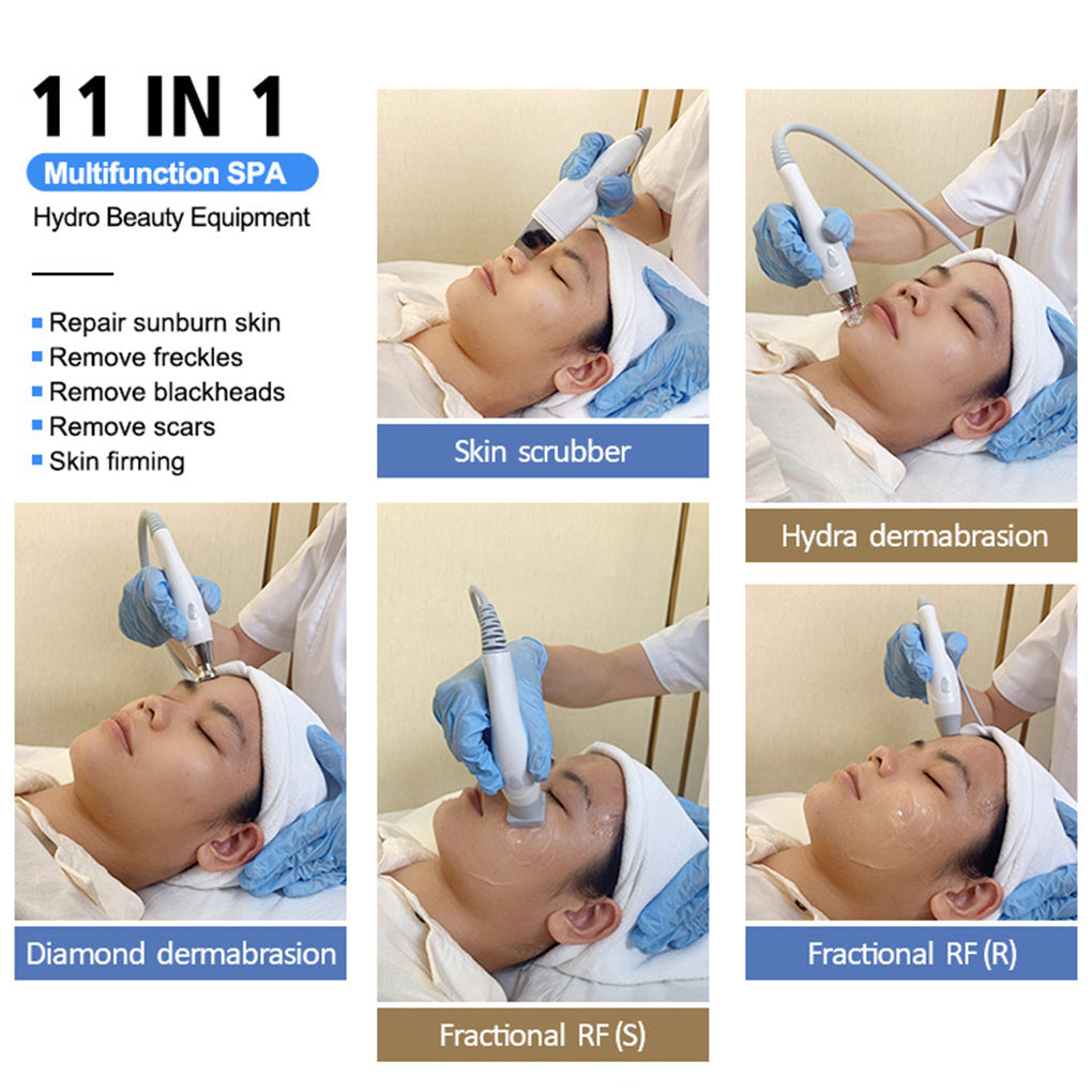 Professional Hydrodermabrasion Facial Machine Supplier Blackhead Removal & Hydration Treatment