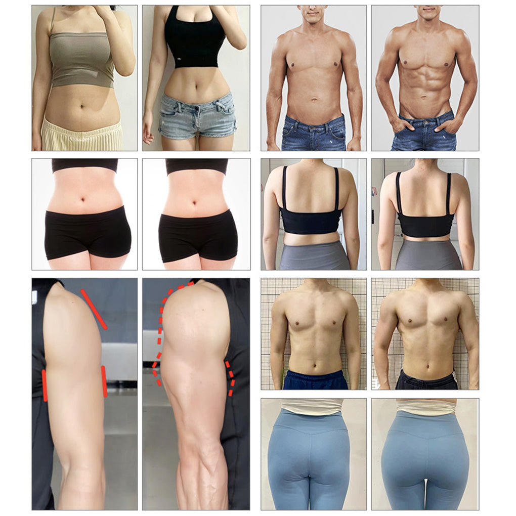 EMS Slimming Machine with Lipolysis Laser and Cryo Plate for Fat Loss Treatment