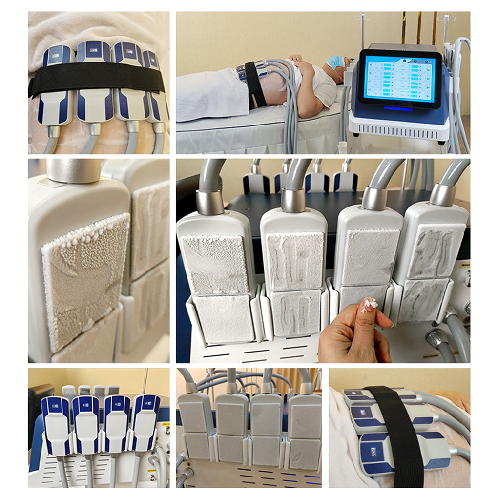 EMS Cryolipolysis Fat Freezing System for Body Shaping & Weight Loss Treatments