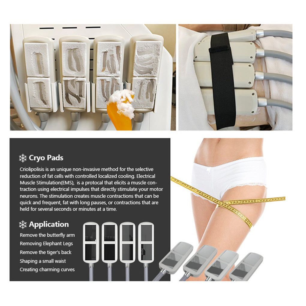 Professional Fat Freezing Cryolipolysis Machine for Abdomen & Thigh Body Contouring