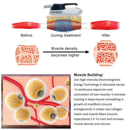 4 Handle EMS Shaping Body Contouring Machine for Muscle Sculpting and Fat Burning