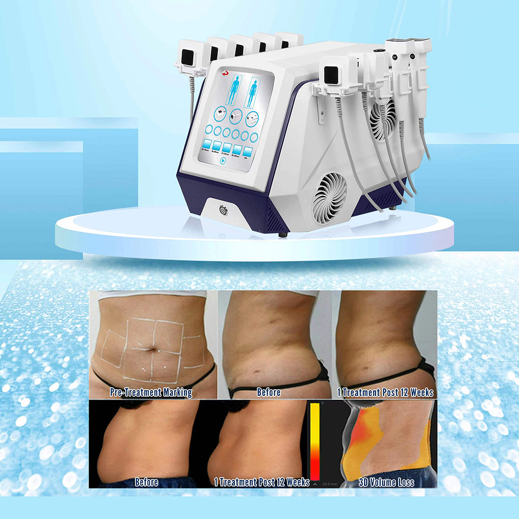 New Body Sculpt Machine RF Fat Reduction Beauty Machine for Double Chin Jawline and Face Tightening