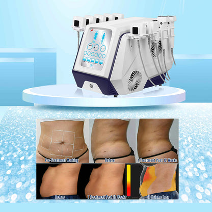 New Body Sculpt Machine RF Fat Reduction Beauty Machine for Double Chin Jawline and Face Tightening