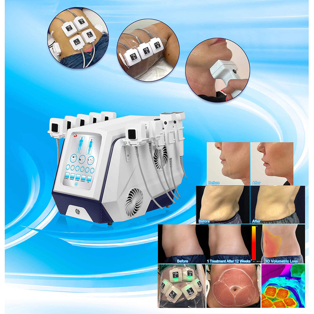 New Body Sculpt Machine RF Fat Reduction Beauty Machine for Double Chin Jawline and Face Tightening