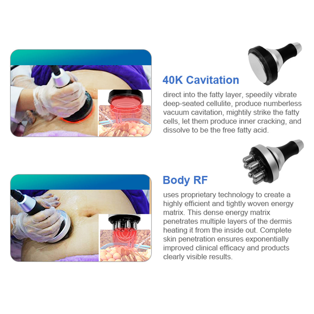 Factory Direct Cryolipolysis Machine 360 Cooling Non-Invasive Fat Loss for Salon Business