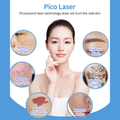 ND YAG Q Switched Laser Machine for Tattoo Removal Carbon Peeling Skin Brightening Treatment