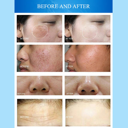 aesthetic machine manufacturer Beauty Salon Facial Machine Multi-Step Skin Rejuvenation & Hydration Care