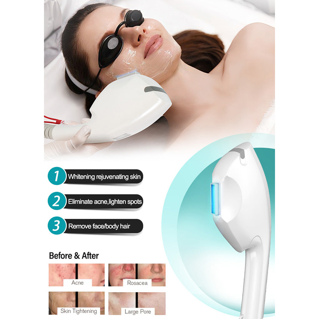 IPL Hair Removal & Q-Switch Laser Machine for Salons and Distributors