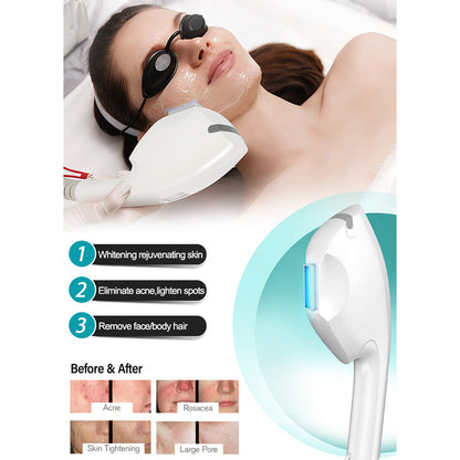 IPL Hair Removal & Q-Switch Laser Machine for Salons and Distributors